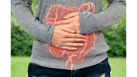 متلازمة القولون العصبي Irritable bowel syndrome (IBS)